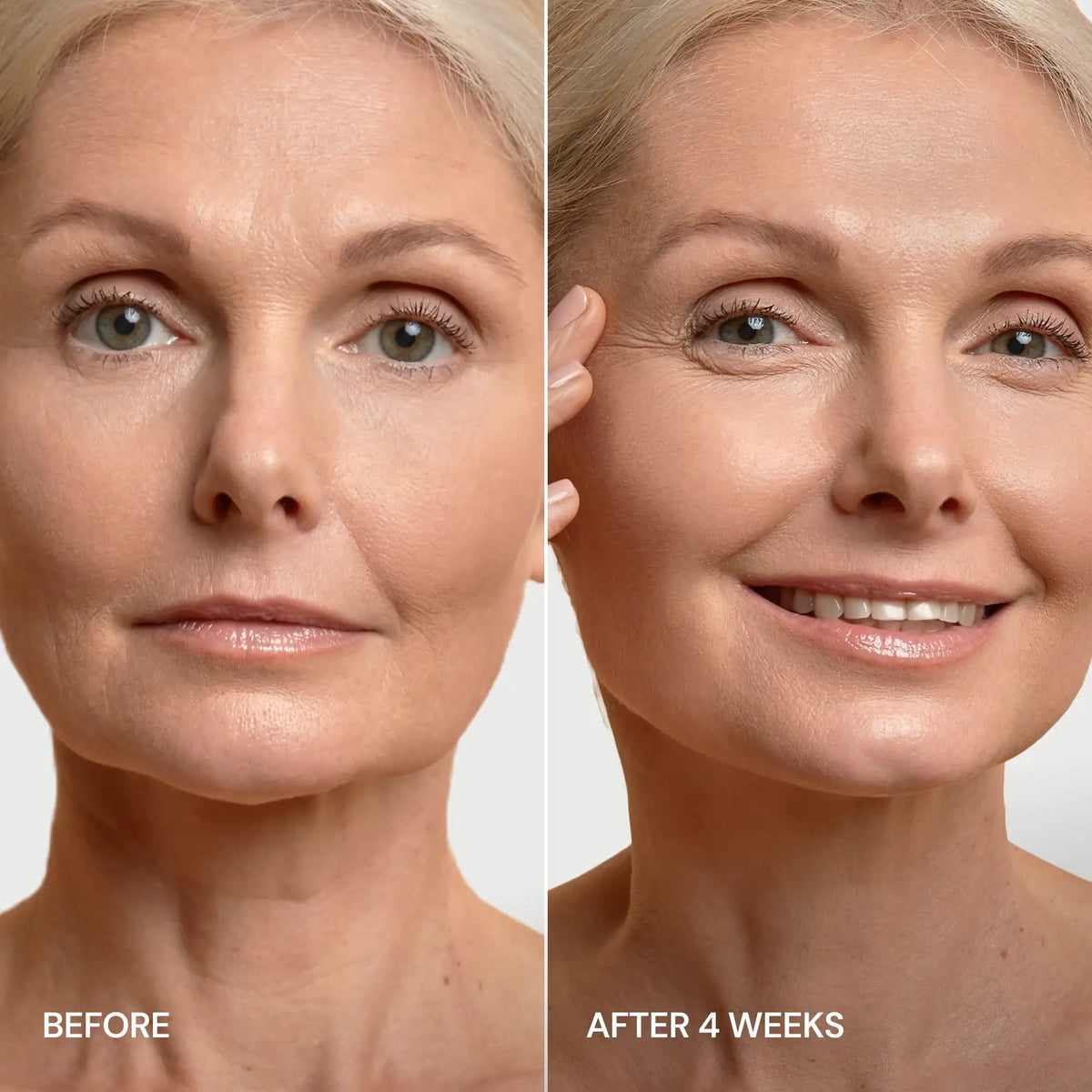 MARÉE Chin Lifting Mask, 24K Gold & Collagen