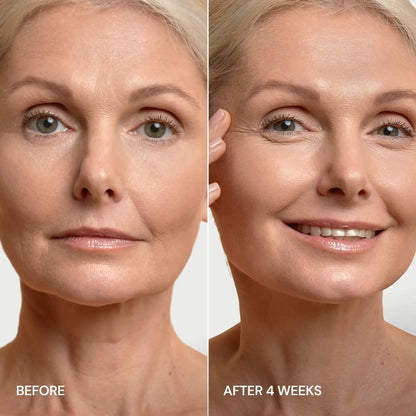 MARÉE Chin Lifting Mask, 24K Gold & Collagen