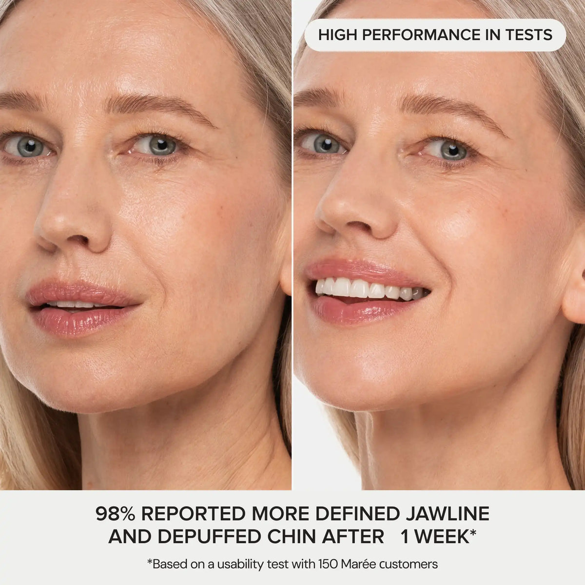 MARÉE Chin Lifting Mask, 24K Gold & Collagen