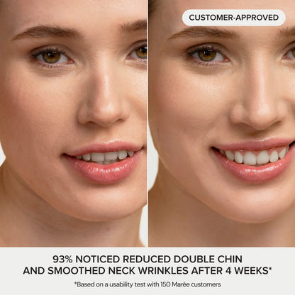 MARÉE Chin Lifting Mask, 24K Gold & Collagen