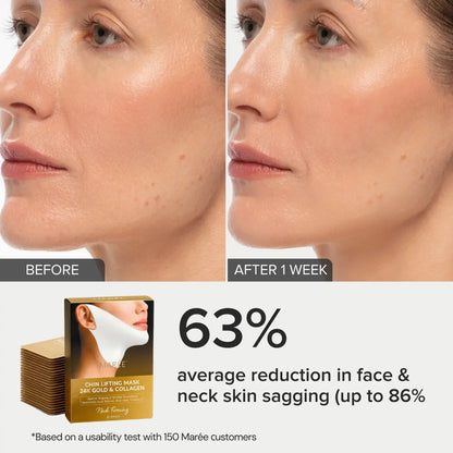 MARÉE Chin Lifting Mask, 24K Gold & Collagen